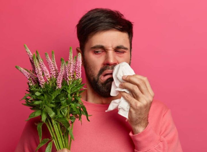 Allergie